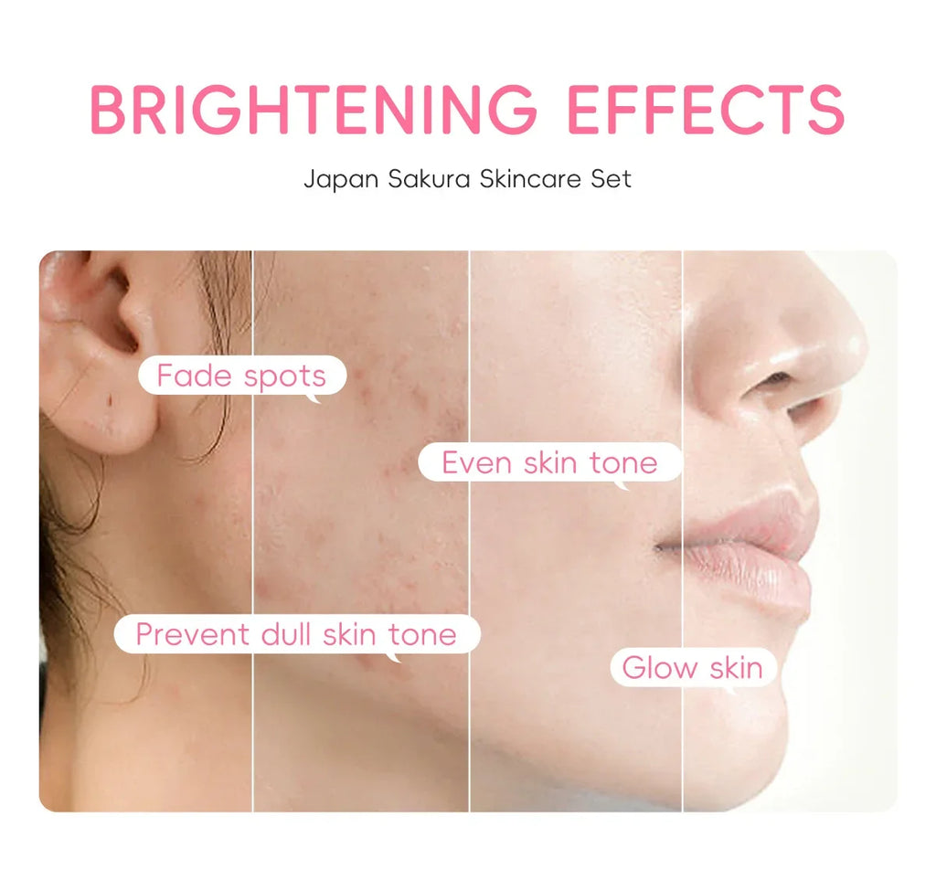 3pcs/Set LAIKOU Sakura Facial Set for Hydrating Moisturizing Whitening and Brightening